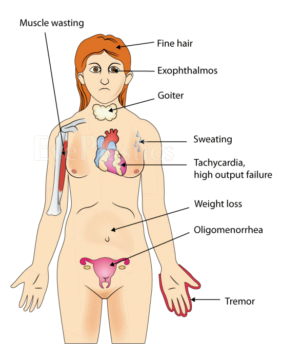 Illustration depicting an overview of the thyroid gland and its surrounding structures.